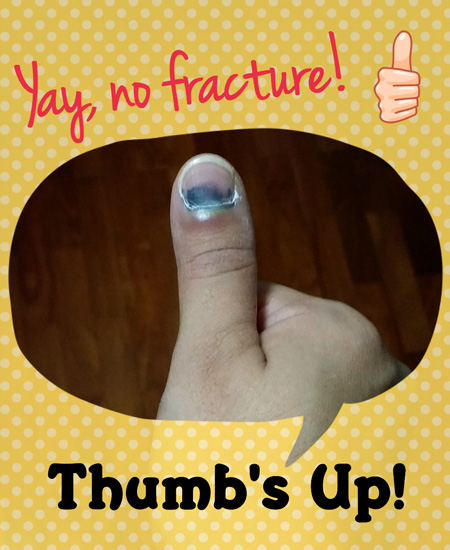swollen thumb joke ups